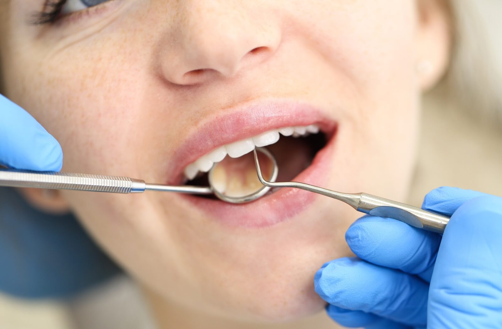 A person is getting their teeth cleaned using a special scaler pick and a mirror to help with seeing the backside of the tooth.
