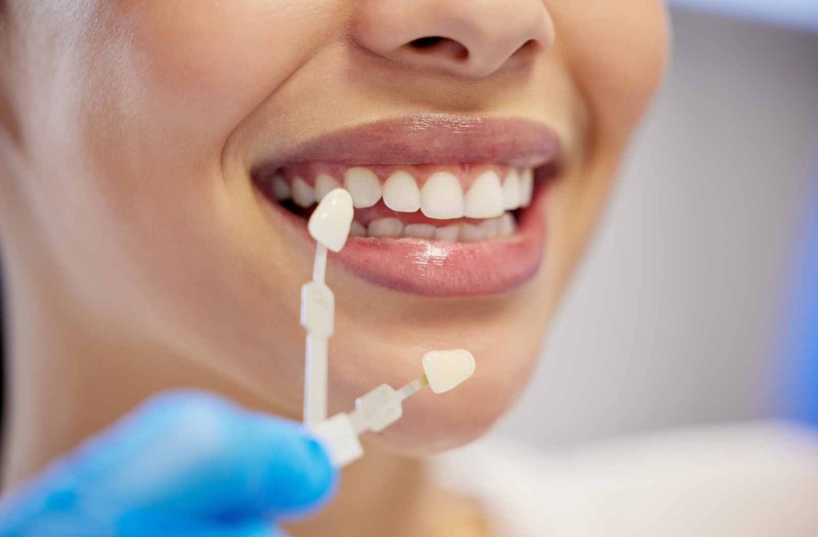 Close-up of a patient holding up a veneer shade guide while discussing options for a customized smile makeover