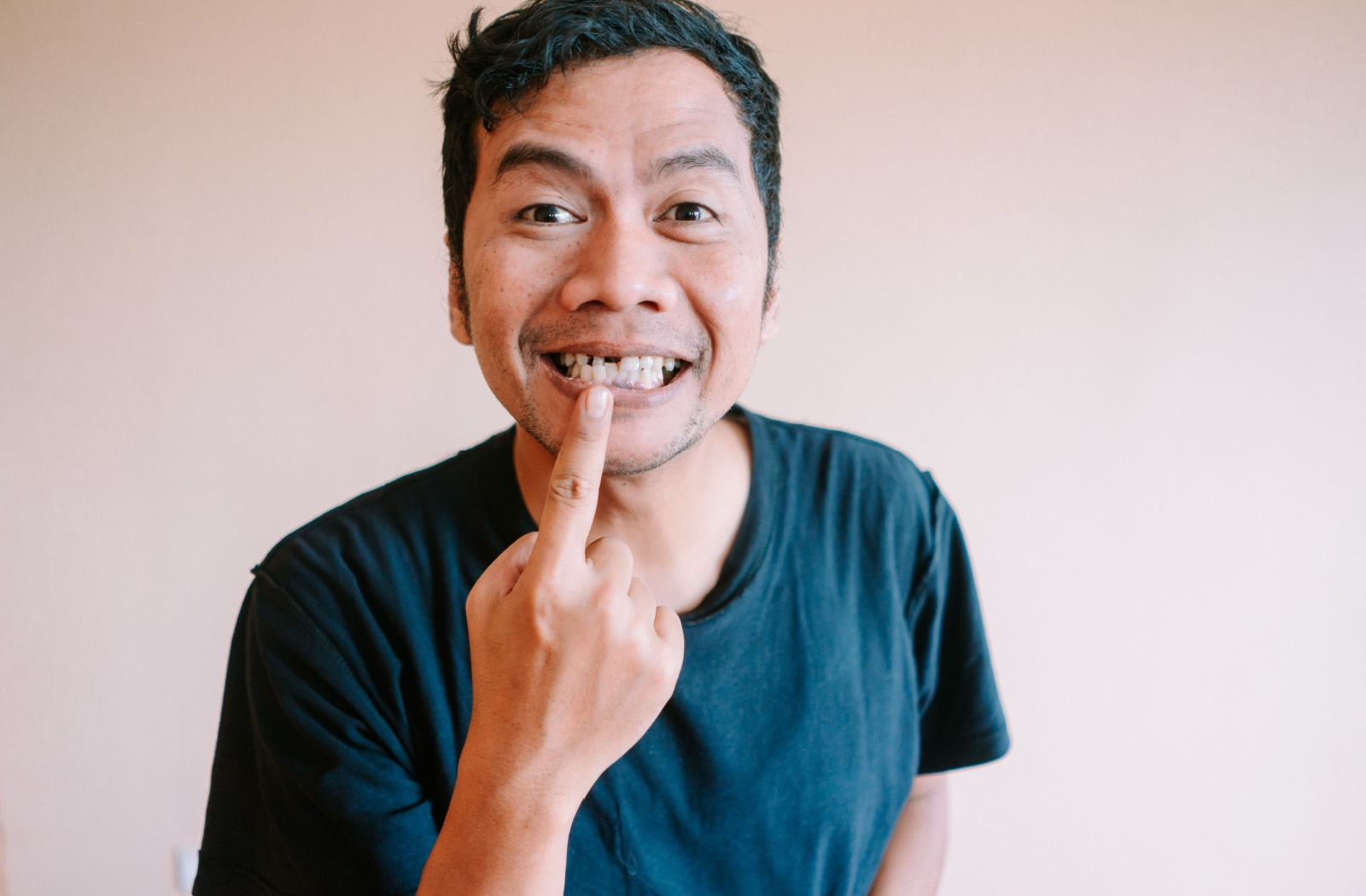 Person smiling and pointing to a missing front tooth while wearing a black shirt against a neutral background