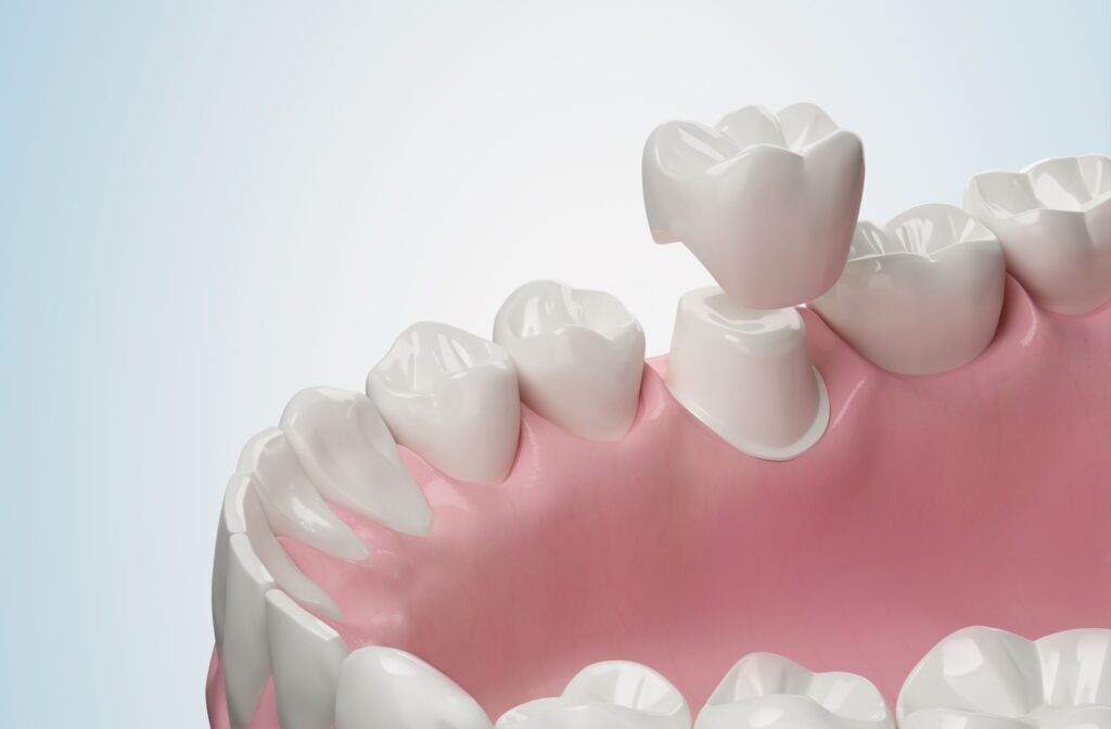 Close-up mock-up image of a dental crown being placed on a tooth.